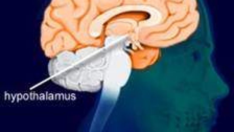 Beyin Kanaması ve Hipotalamus